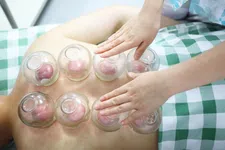 Thumbnail for article: Cupping is niet zomaar een trend: Op deze manieren verbetert het je rijhouding