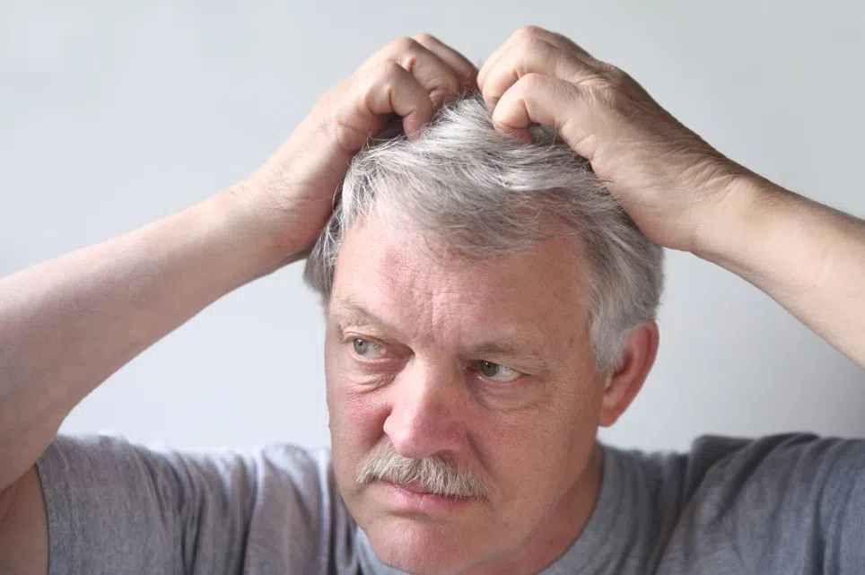 Jeukende hoofdhuid onder je helm
